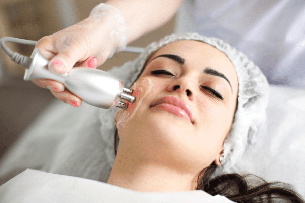 Radiofrecuencia facial